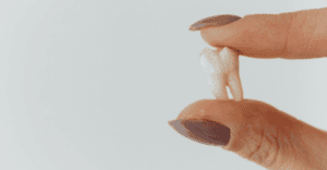 Tooth Extractions